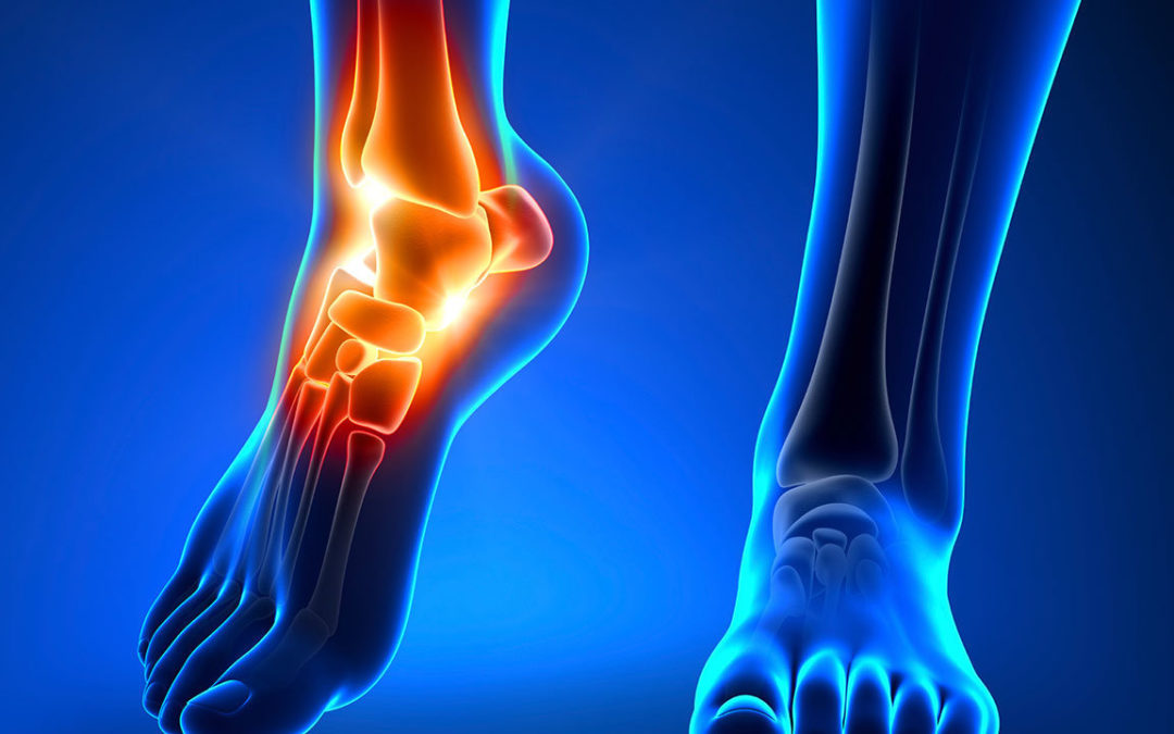Employee blames foot injury on Chicago Area contractors and sues